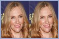 Toni Collette Teeth Before And After | What Is Wrong With Her Face